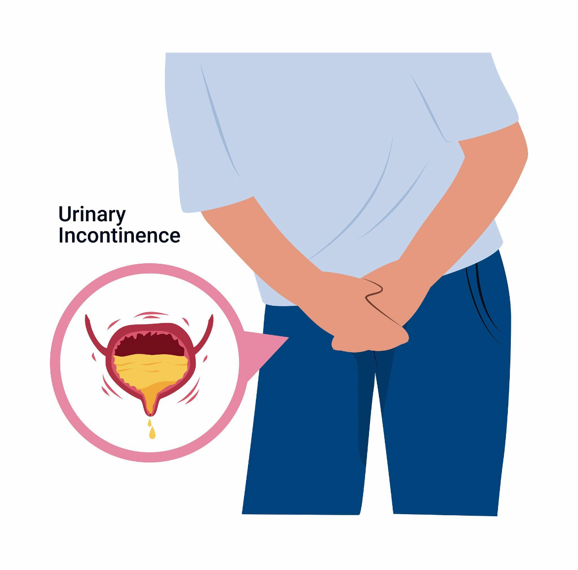 Urinary Incontinence: Regain Control with Expert Care | Dr Vikas Gupta ...