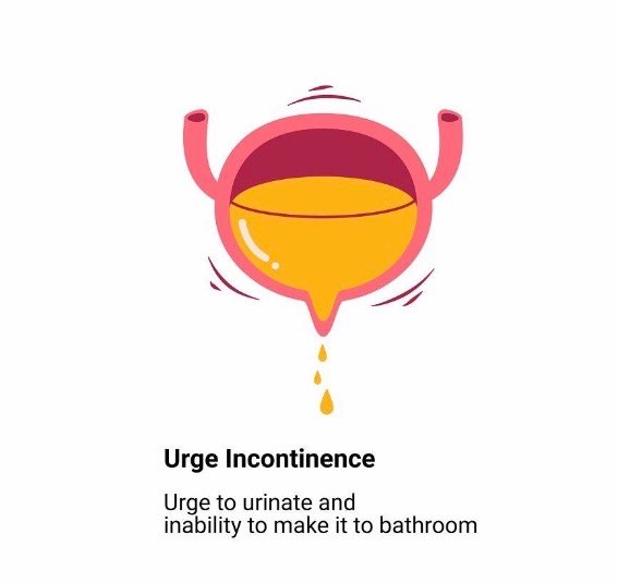 Urge incontinence