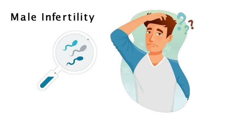 Male Infertility
